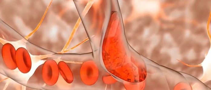 神州医疗基因检测助力静脉内血栓栓塞症（VTE）的早期筛查