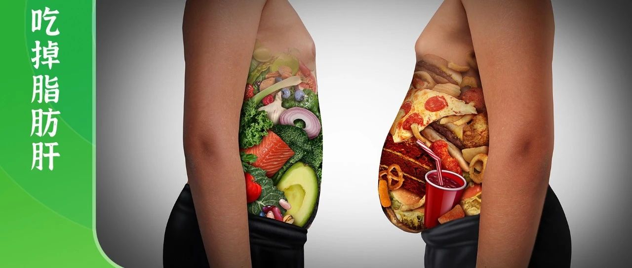 吃掉脂肪肝！常吃5类食物，把吃出来的脂肪肝再吃回去！
