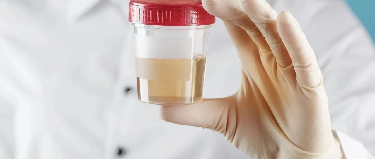 应用案例 I 原子荧光光谱法测定尿液中的砷的含量