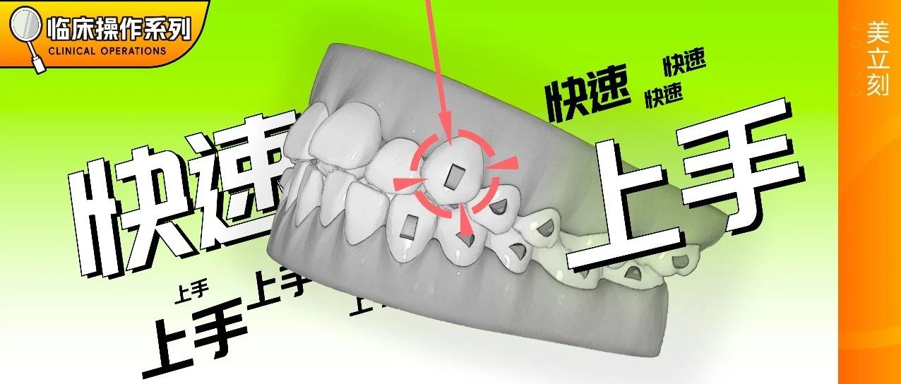 「临床操作」隐形正畸附件粘接的步骤详解&注意事项