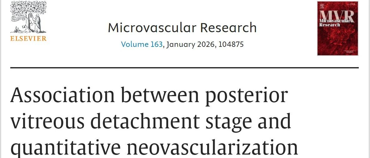 玻璃体后脱离与新生血管相关性，SS-OCT助力PDR与NV形态研究