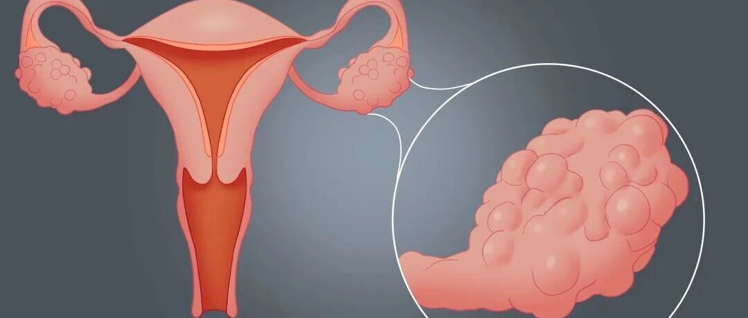 这几种妇科病，跟性生活根本不沾边！男女都要了解，别让无知害了你